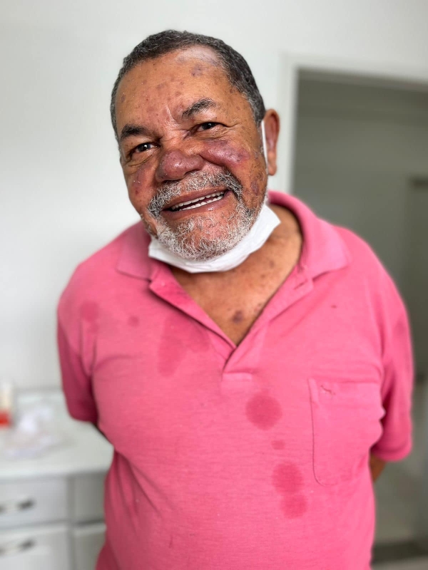 PROGRAMA &quot;DS SORRIDENTE&quot; JÁ BENEFICIOU 52 SILVERIENSES
